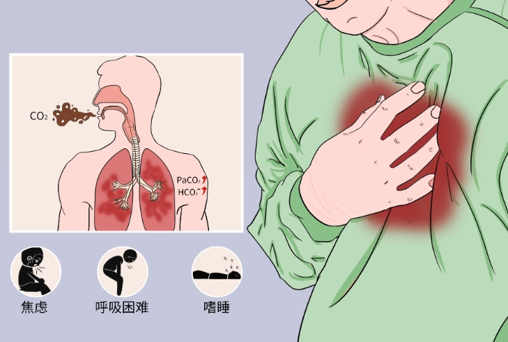 酸味敏感 酸味敏感