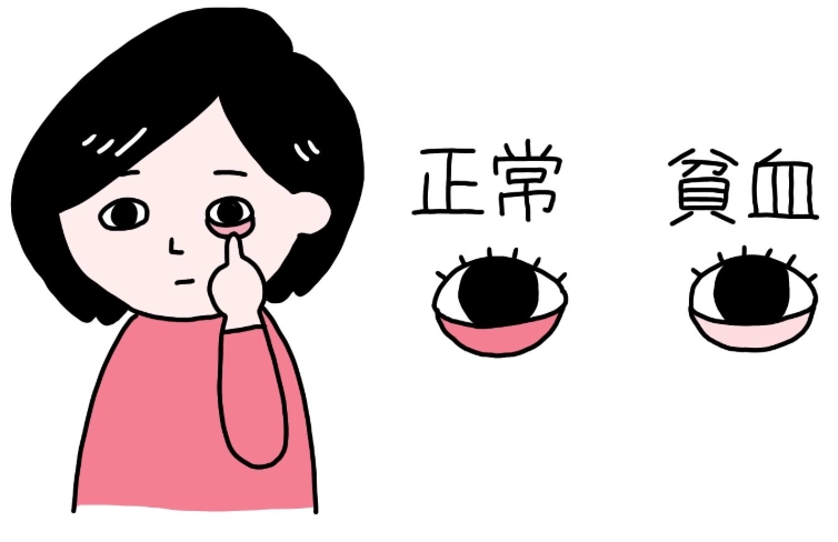 女性貧血原因 女性貧血原因