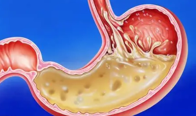 胃不舒服喝什麼