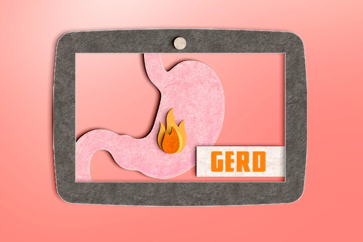 優酪乳緩解胃酸