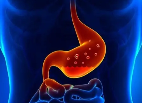 胃黏膜修復時間全解析：修復週期、加速方法與保養指南
