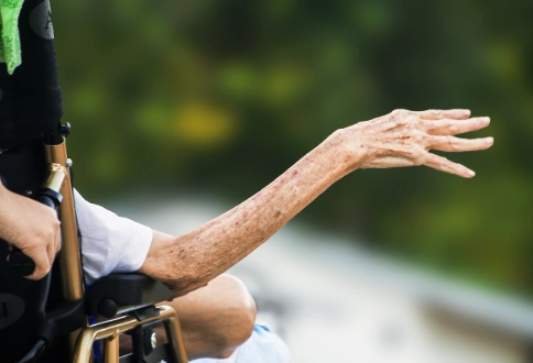 老人鉀離子過高原因解析：飲食、藥物與腎臟功能關鍵