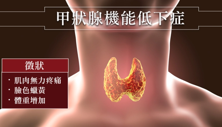 甲狀腺低下飲食 甲狀腺低下飲食