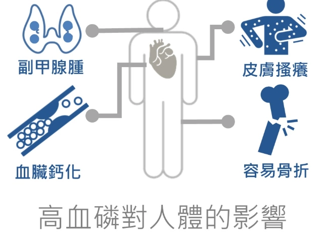 高磷食物對腎臟的影響：完整飲食指南與避坑清單