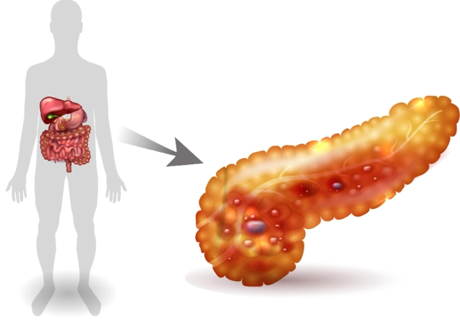 多囊性卵巢檢查費用