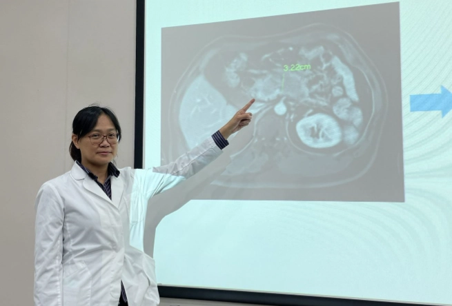 壞死性胰臟炎是什麼？致命風險、症狀與治療全解析