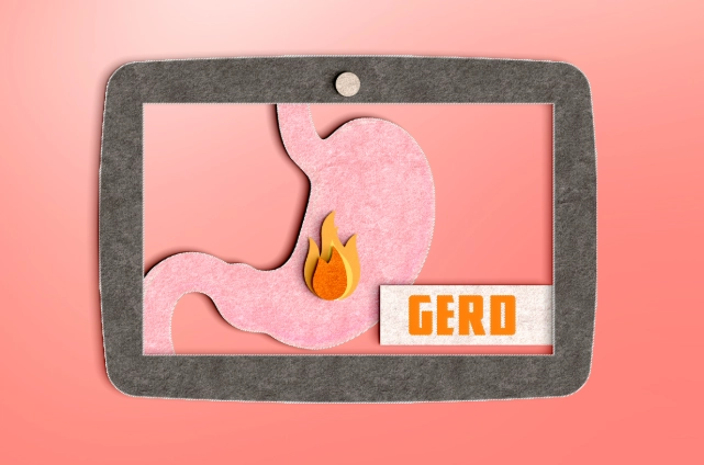 孕婦胃食道逆流飲品