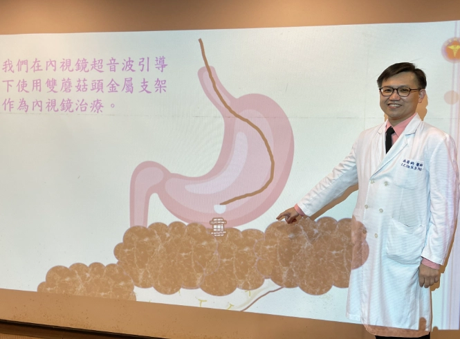 急性胰臟炎 治療