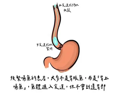 經常嗝氣原因 經常嗝氣原因