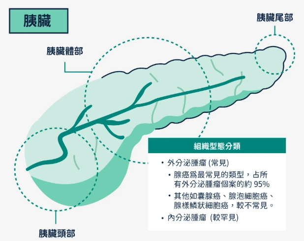多囊性卵巢檢查項目