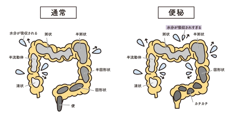 益生菌飲食 益生菌飲食