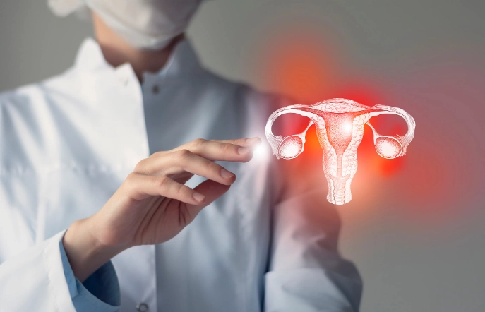 多囊性卵巢手術