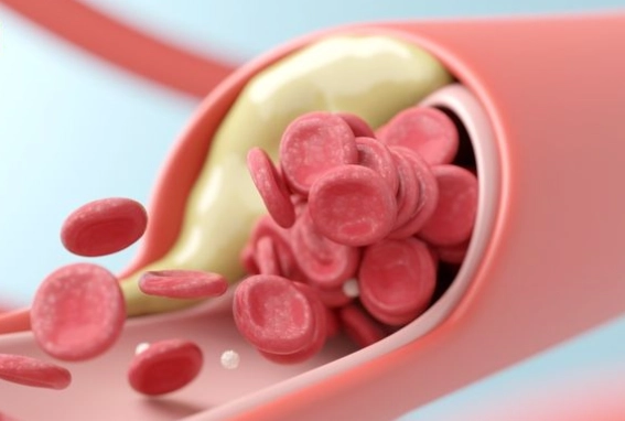 血管鈣化運動指南：逆轉鈣化的三大運動關鍵與常見誤區