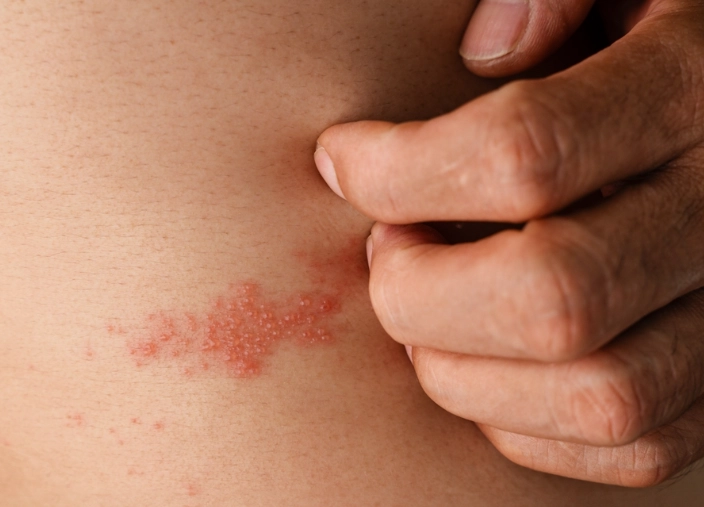 皮蛇可以吃海鮮嗎 皮蛇可以吃海鮮嗎