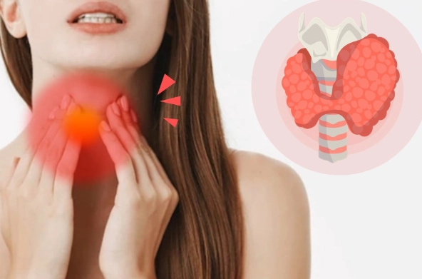 甲狀腺亢進影響 甲狀腺亢進影響