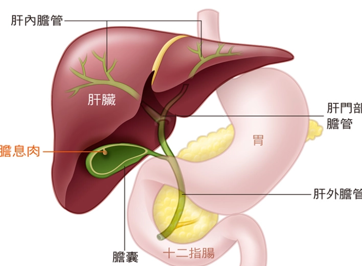 膽囊炎 胰臟炎 飲食