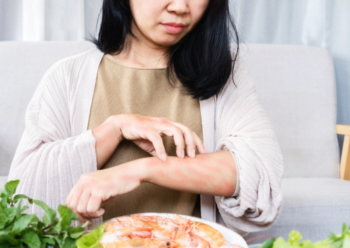 過敏體質飲食 過敏體質飲食