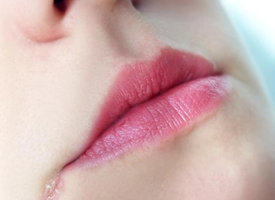 唇皰疹初期圖片 唇皰疹初期圖片