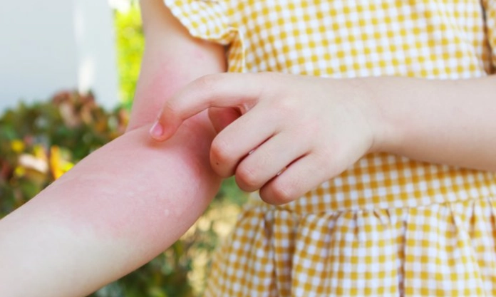 抗組織胺副作用