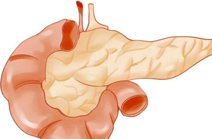 胰島素 治療 胰臟炎 胰島素 治療 胰臟炎