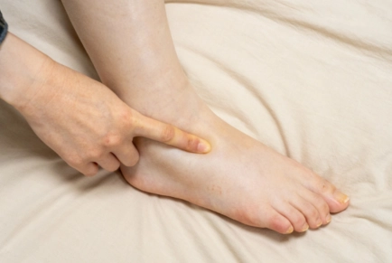 腳水腫怎麼辦？中藥方調理與日常保健全攻略