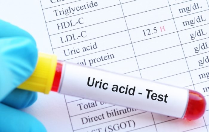 高尿酸有什麼症狀