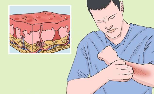 酒精代謝過程 酒精代謝過程