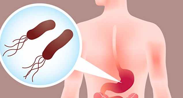 紅蘿蔔對胃潰瘍的影響 紅蘿蔔對胃潰瘍的影響