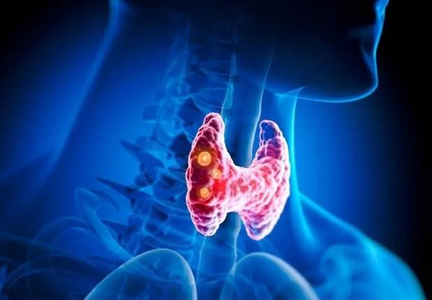 甲狀腺功能低下 飲食