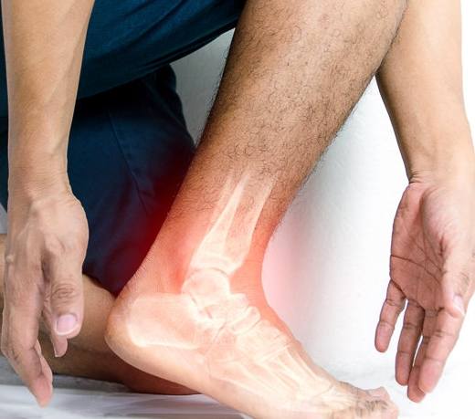 痛風飲食 蔬菜 痛風飲食 蔬菜