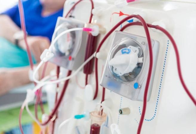 洗腎飲食木瓜 洗腎飲食木瓜