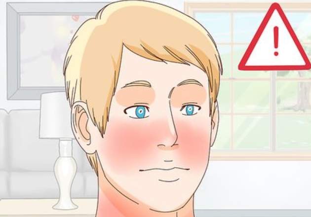 酒精過敏處理 酒精過敏處理