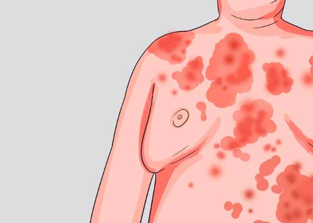 酒精反應症狀 酒精反應症狀