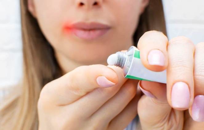 嘴唇水泡原因 嘴唇水泡原因