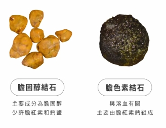 胰臟壞死症狀 胰臟壞死症狀