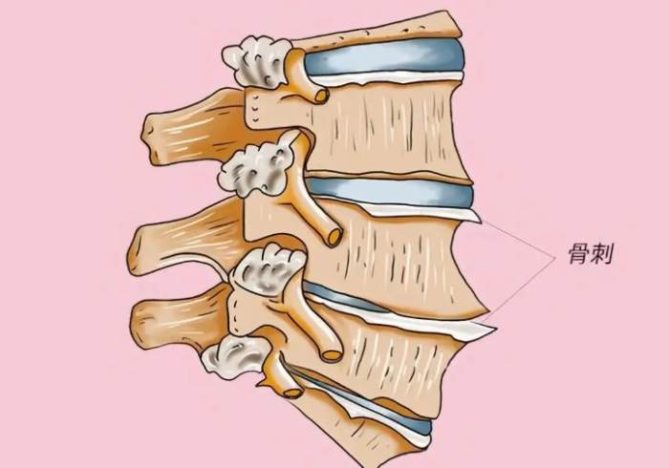 長骨刺不能吃的東西