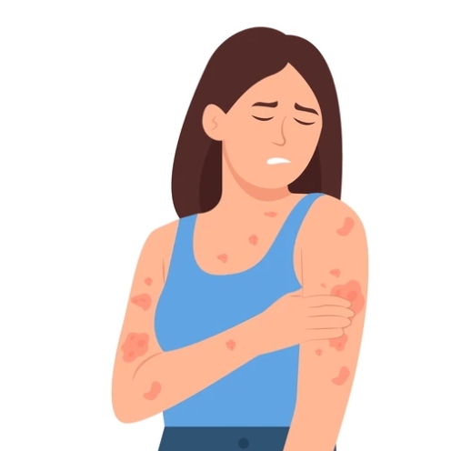 皮膚過敏飲食禁忌 皮膚過敏飲食禁忌