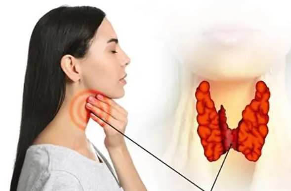 甲狀腺亢進 營養 甲狀腺亢進 營養