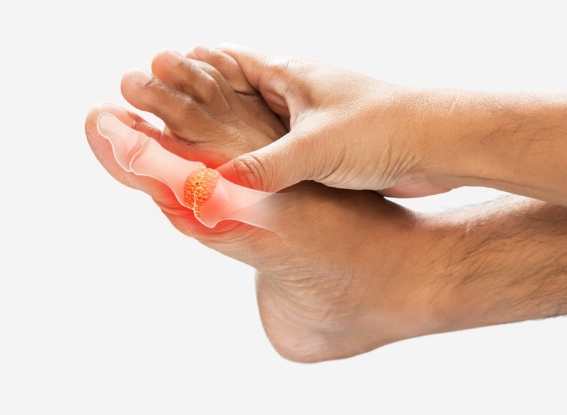 納豆副作用 納豆副作用