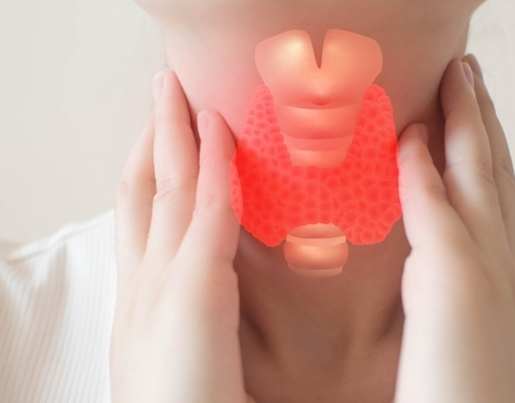 甲狀腺亢進不能吃的食物 甲狀腺亢進不能吃的食物