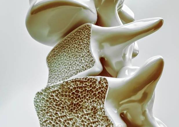 骨質疏鬆改善方法 骨質疏鬆改善方法