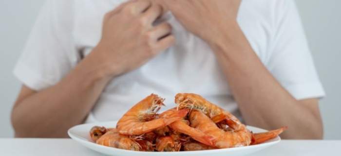 吃蝦過敏解毒的小妙招