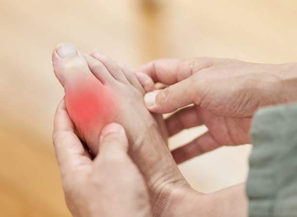 高尿酸血症症狀 高尿酸血症症狀