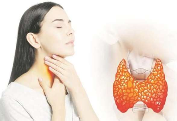 甲狀腺亢進 飲食 甲狀腺亢進 飲食