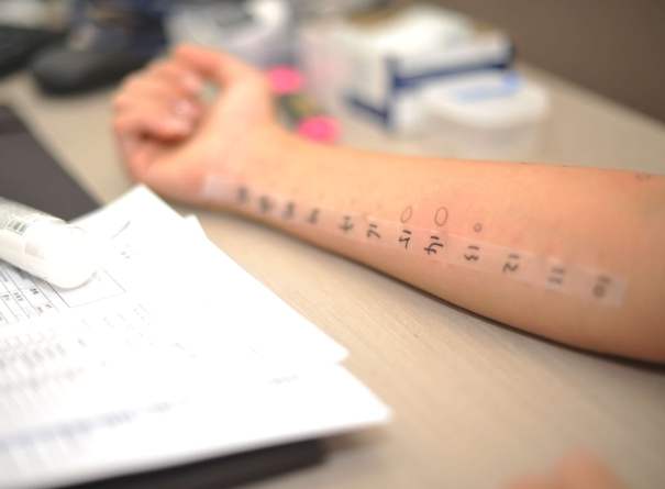 過敏不能吃的水果 過敏不能吃的水果