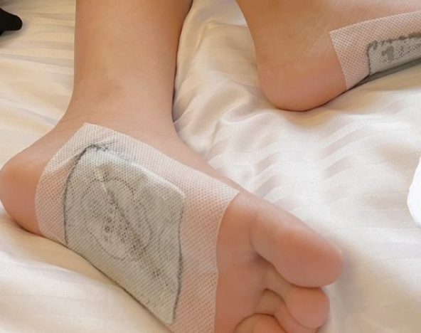 老北京足貼可以每天貼嗎