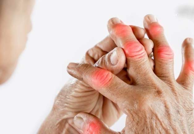 消炎食物避免 消炎食物避免