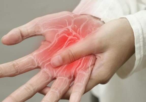 高尿酸血症症狀 高尿酸血症症狀