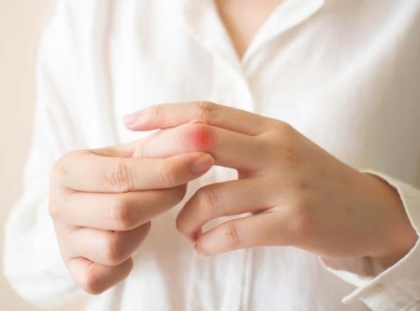 手發炎飲食指南 手發炎飲食指南