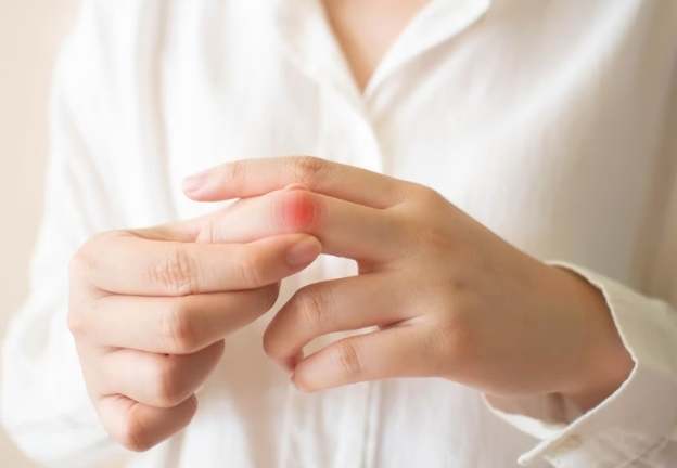 手指關節炎飲食